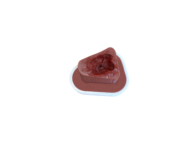 Ven Bleed