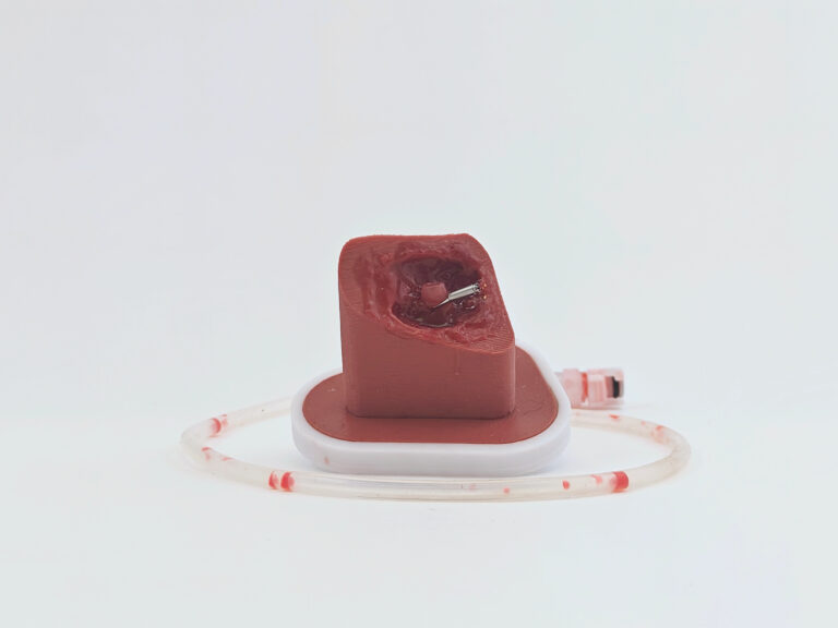 Ventricle Bleeding Insert 1