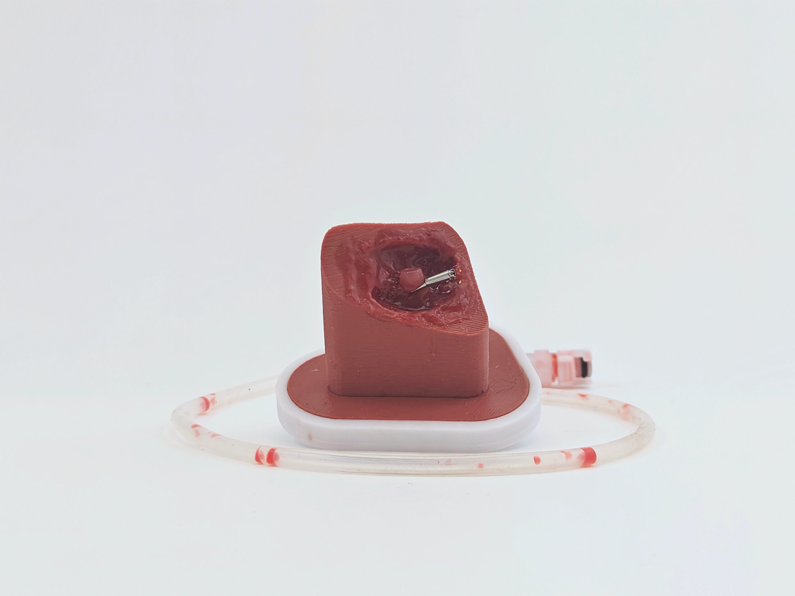 Ventricle Bleeding Insert 1 Ventricle Bleeding Insert